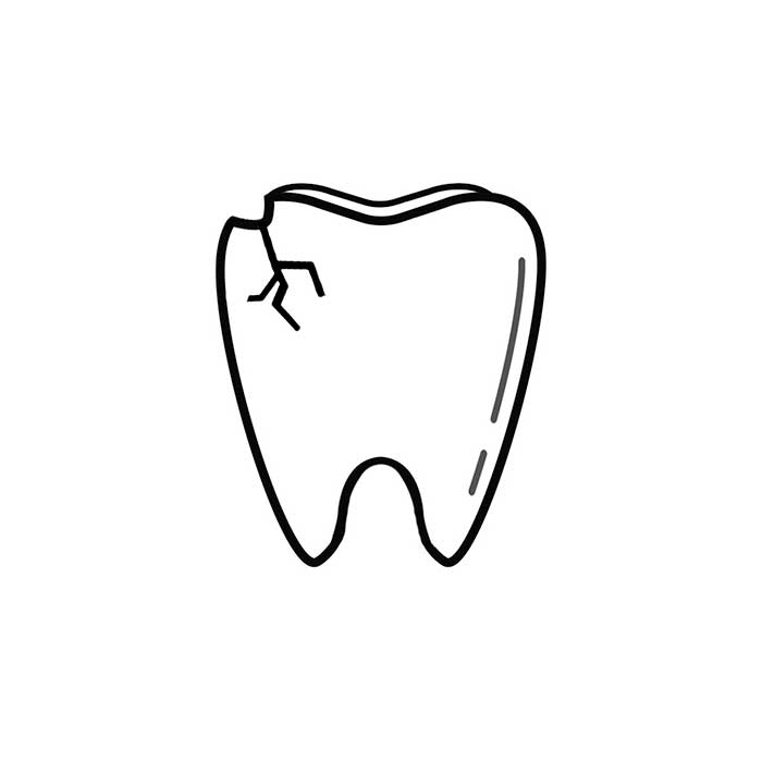 Image of a chipped tooth